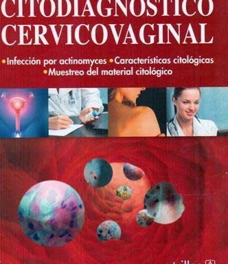 Citodiagnóstico cervicovaginal