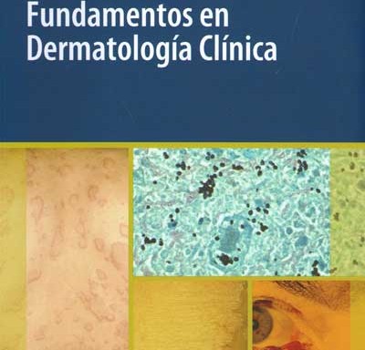 Fundamentos en dermatología clínica