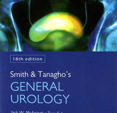 Smith y Tanago Urología General